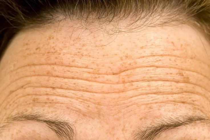 Primeros signos de edad: ¿cuándo empezar una rutina antiedad?